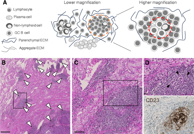 Figure 3 for Hitchhiker's guide to cancer-associated lymphoid aggregates in histology images: manual and deep learning-based quantification approaches