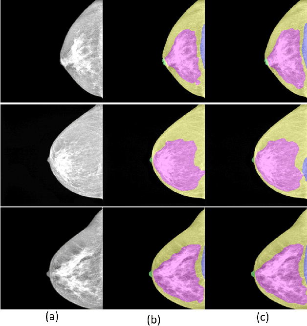 Figure 2 for Towards Automated Semantic Segmentation in Mammography Images