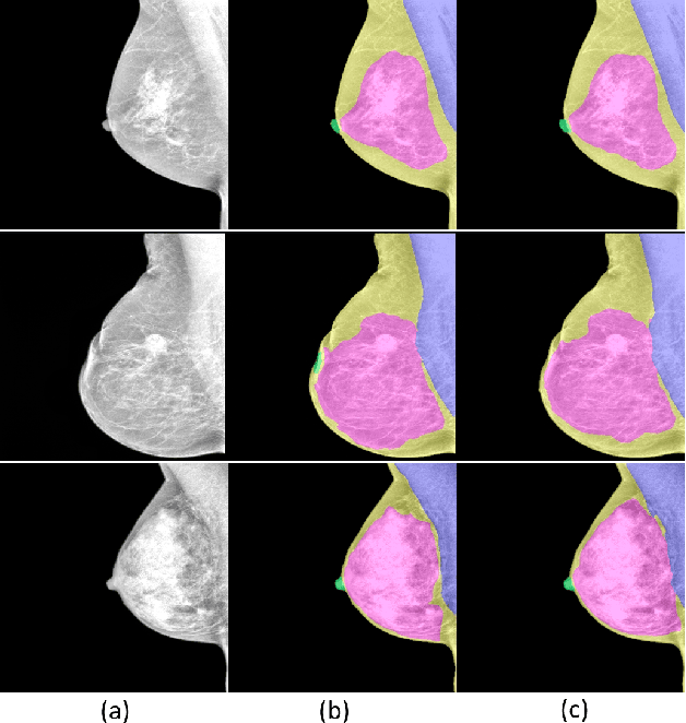 Figure 3 for Towards Automated Semantic Segmentation in Mammography Images