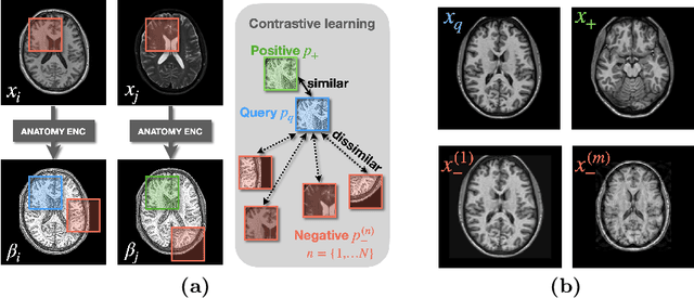 Figure 3 for HACA3: A Unified Approach for Multi-site MR Image Harmonization