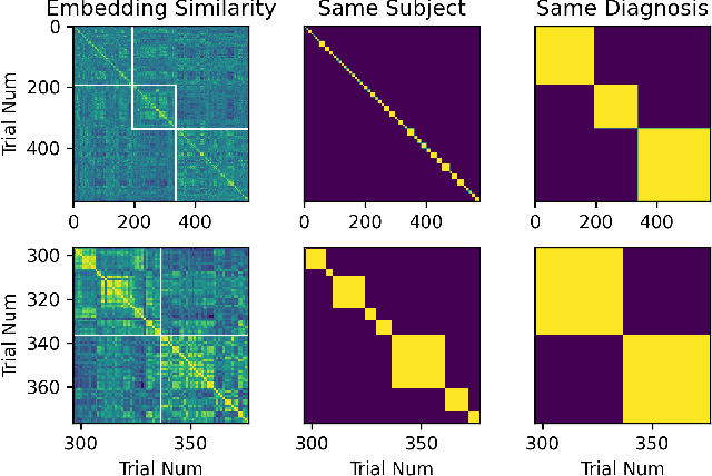 Figure 2 for Self-Supervised Learning of Gait-Based Biomarkers