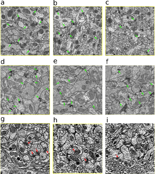 Figure 2 for An Out-of-Domain Synapse Detection Challenge for Microwasp Brain Connectomes