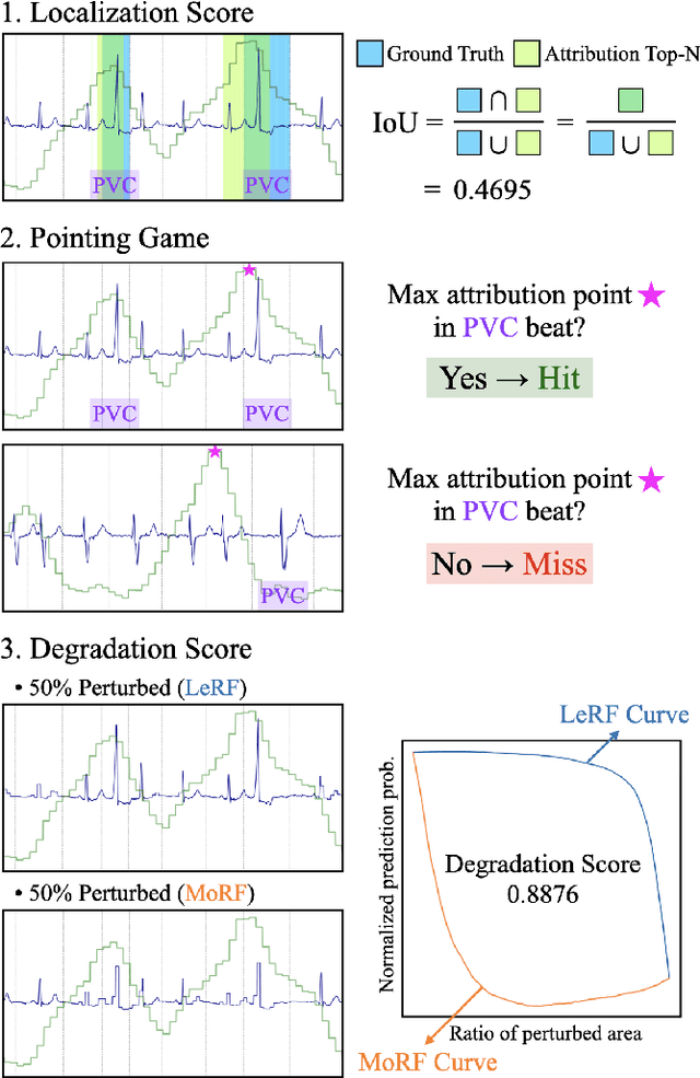 Figure 1 for Evaluating Feature Attribution Methods for Electrocardiogram