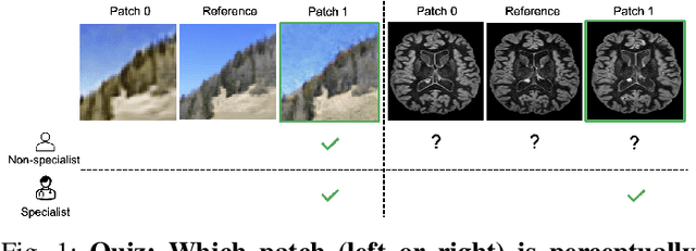 Figure 1 for A Domain-specific Perceptual Metric via Contrastive Self-supervised Representation: Applications on Natural and Medical Images