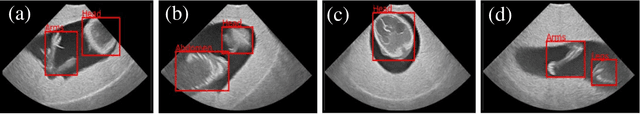 Figure 1 for FPUS23: An Ultrasound Fetus Phantom Dataset with Deep Neural Network Evaluations for Fetus Orientations, Fetal Planes, and Anatomical Features