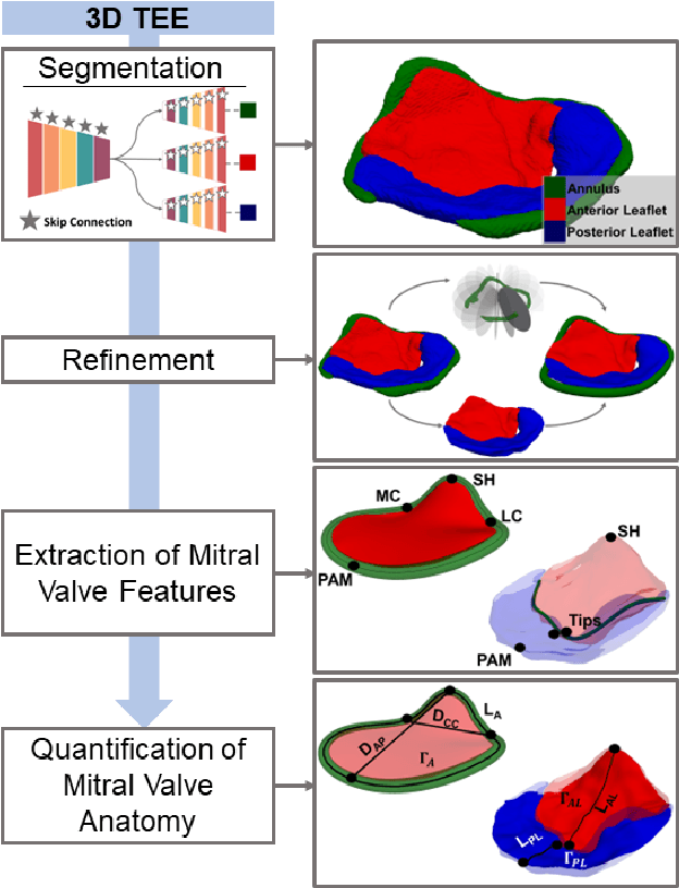 Figure 3 for A Deep Learning-Based and Fully Automated Pipeline for Regurgitant Mitral Valve Anatomy Analysis from 3D Echocardiography