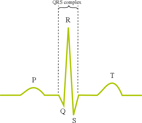 Figure 1 for Leveraging Statistical Shape Priors in GAN-based ECG Synthesis