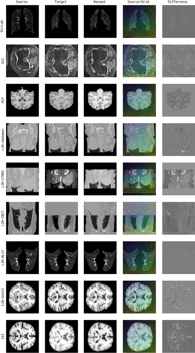 Figure 4 for uniGradICON: A Foundation Model for Medical Image Registration