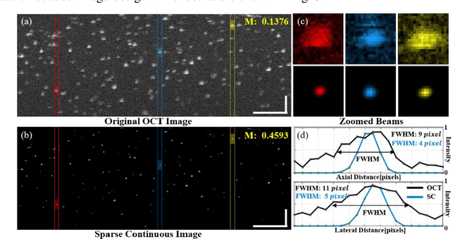 Figure 3 for Resolution Improvement for OpticalCoherence Tomography based on Sparse Continuous Deconvolution