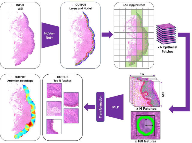 Figure 2 for A Fully Automated and Explainable Algorithm for the Prediction of Malignant Transformation in Oral Epithelial Dysplasia