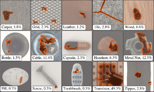 Figure 1 for MSFlow: Multi-Scale Flow-based Framework for Unsupervised Anomaly Detection