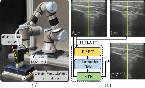 Figure 1 for Unsupervised Deformable Image Registration for Respiratory Motion Compensation in Ultrasound Images