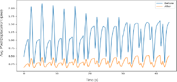 Figure 2 for Unsupervised Deformable Image Registration for Respiratory Motion Compensation in Ultrasound Images