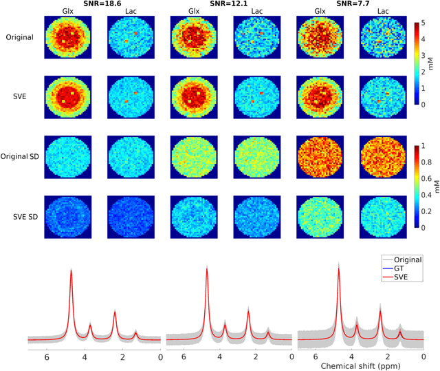 Figure 4 for A Deep Learning Method for Sensitivity Enhancement of Deuterium Metabolic Imaging (DMI)