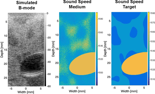 Figure 1 for Investigating Pulse-Echo Sound Speed Estimation in Breast Ultrasound with Deep Learning