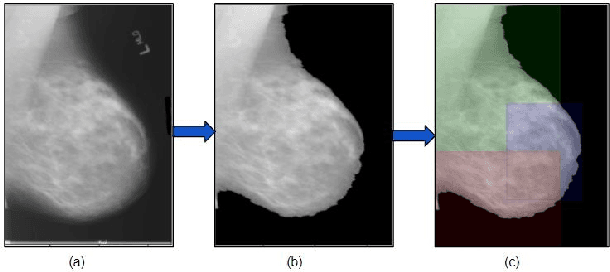 Figure 1 for STEM Rebalance: A Novel Approach for Tackling Imbalanced Datasets using SMOTE, Edited Nearest Neighbour, and Mixup