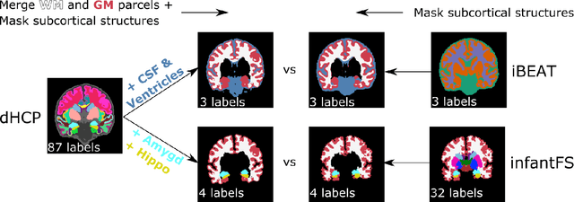 Figure 3 for VINNA for Neonates -- Orientation Independence through Latent Augmentations