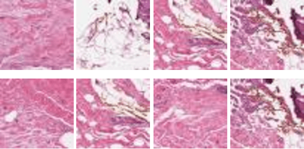 Figure 3 for A Deep Analysis of Transfer Learning Based Breast Cancer Detection Using Histopathology Images