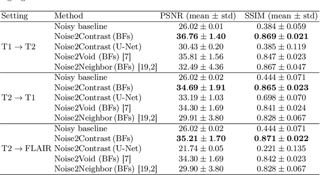 Figure 2 for Noise2Contrast: Multi-Contrast Fusion Enables Self-Supervised Tomographic Image Denoising