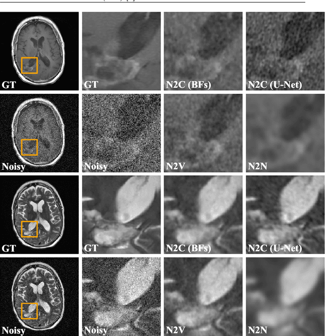 Figure 4 for Noise2Contrast: Multi-Contrast Fusion Enables Self-Supervised Tomographic Image Denoising
