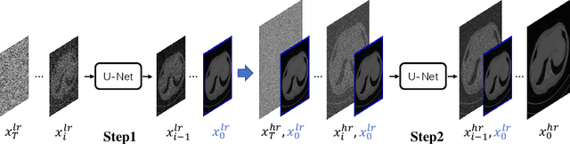 Figure 1 for A Diffusion Probabilistic Prior for Low-Dose CT Image Denoising