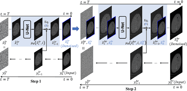 Figure 3 for A Diffusion Probabilistic Prior for Low-Dose CT Image Denoising