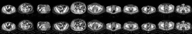 Figure 4 for A Diffusion Probabilistic Prior for Low-Dose CT Image Denoising