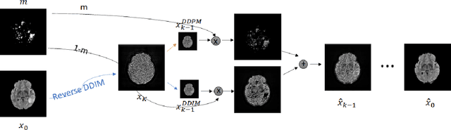 Figure 1 for Diffusion Models for Counterfactual Generation and Anomaly Detection in Brain Images