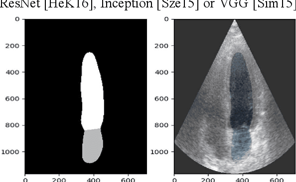 Figure 3 for Estimation of mitral valve hinge point coordinates -- deep neural net for echocardiogram segmentation