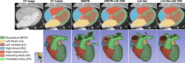Figure 3 for Dual self-distillation of U-shaped networks for 3D medical image segmentation