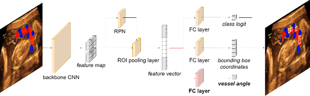 Figure 3 for An Automatic Guidance and Quality Assessment System for Doppler Imaging of Umbilical Artery