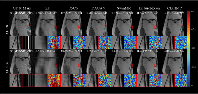 Figure 4 for CDiffMR: Can We Replace the Gaussian Noise with K-Space Undersampling for Fast MRI?