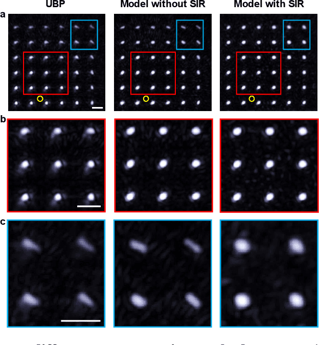 Figure 3 for Single-shot 3D photoacoustic computed tomography with a densely packed array for transcranial functional imaging