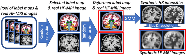 Figure 2 for Accurate super-resolution low-field brain MRI