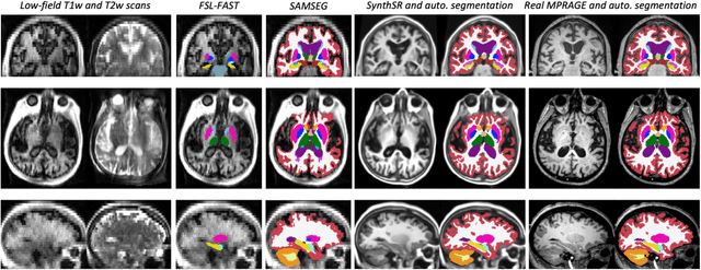 Figure 4 for Accurate super-resolution low-field brain MRI