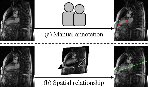 Figure 1 for Automatic view plane prescription for cardiac magnetic resonance imaging via supervision by spatial relationship between views