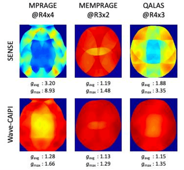 Figure 3 for Wave-Encoded Model-based Deep Learning for Highly Accelerated Imaging with Joint Reconstruction