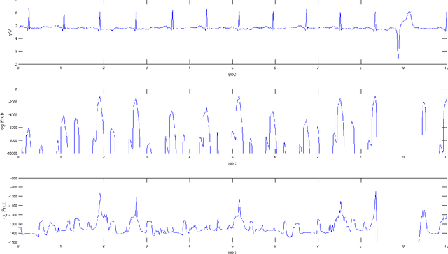 Figure 3 for Parameterization of state duration in Hidden semi-Markov Models: an application in electrocardiography