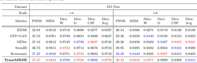 Figure 3 for TransMRSR: Transformer-based Self-Distilled Generative Prior for Brain MRI Super-Resolution