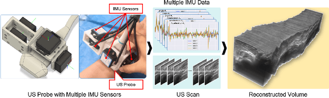 Figure 1 for Multi-IMU with Online Self-Consistency for Freehand 3D Ultrasound Reconstruction