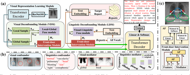 Figure 3 for Visual-Linguistic Causal Intervention for Radiology Report Generation