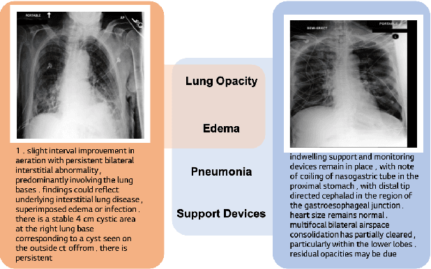 Figure 1 for Significantly improving zero-shot X-ray pathology classification via fine-tuning pre-trained image-text encoders