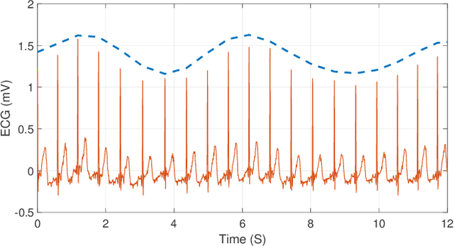 Figure 1 for Real-time Wireless ECG-derived Respiration Rate Estimation Using an Autoencoder with a DCT Layer