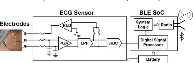Figure 3 for Real-time Wireless ECG-derived Respiration Rate Estimation Using an Autoencoder with a DCT Layer
