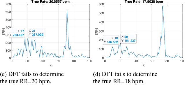 Figure 4 for Real-time Wireless ECG-derived Respiration Rate Estimation Using an Autoencoder with a DCT Layer