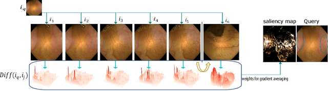 Figure 1 for This changes to that : Combining causal and non-causal explanations to generate disease progression in capsule endoscopy