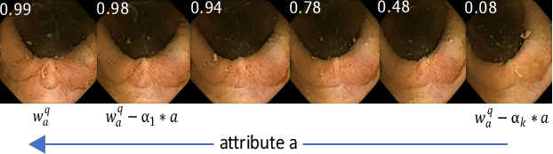 Figure 3 for This changes to that : Combining causal and non-causal explanations to generate disease progression in capsule endoscopy