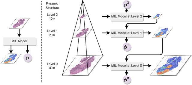 Figure 1 for Diagnose Like a Pathologist: Transformer-Enabled Hierarchical Attention-Guided Multiple Instance Learning for Whole Slide Image Classification