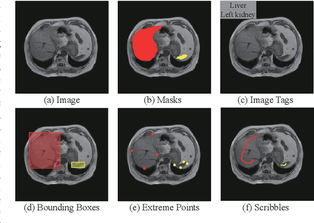 Figure 1 for Volumetric Medical Image Segmentation via Scribble Annotations and Shape Priors