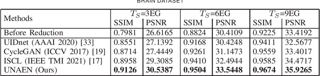 Figure 4 for UNAEN: Unsupervised Abnomality Extraction Network for MRI Motion Artifact Reduction